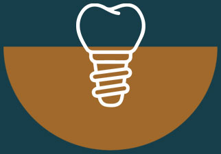 icono implante dental